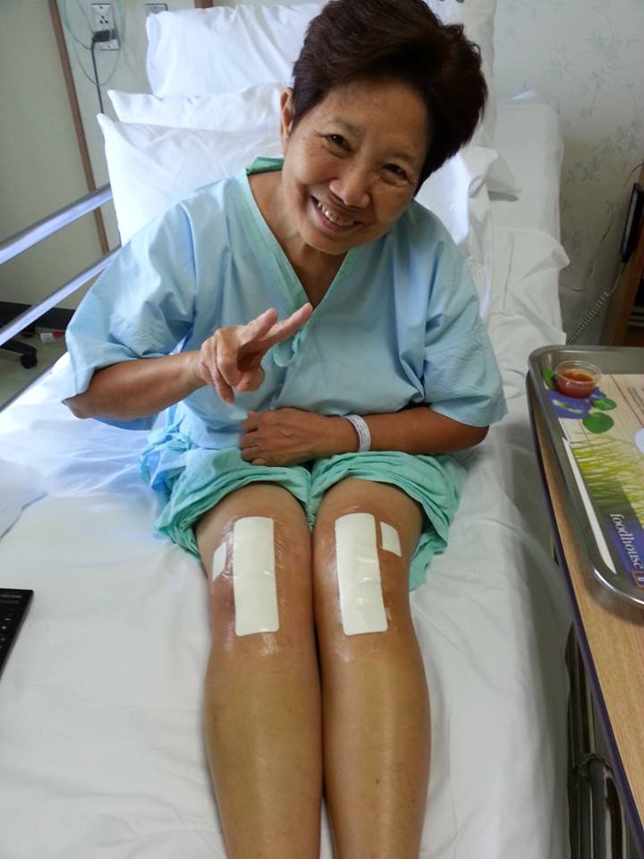 ผ่าตัดเปลี่ยนข้อเข่าเทียม