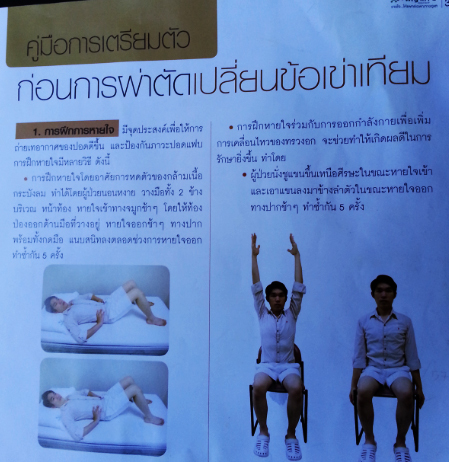 ผ่าตัดเปลี่ยนข้อเข่าเทียม