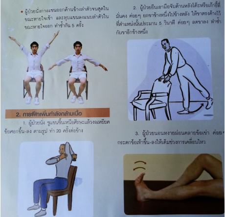 ผ่าตัดเปลี่ยนข้อเข่าเทียม