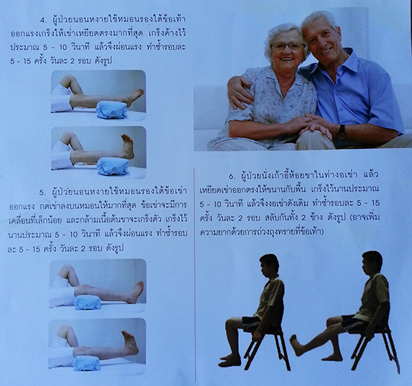 ผ่าตัดเปลี่ยนข้อเข่าเทียม