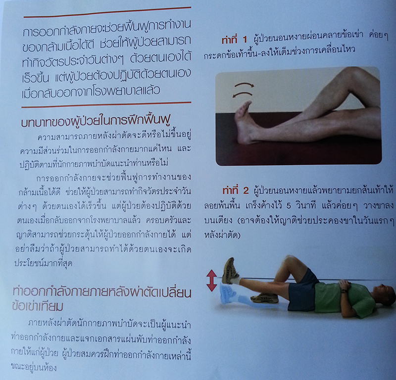 ผ่าตัดเปลี่ยนข้อเข่าเทียม