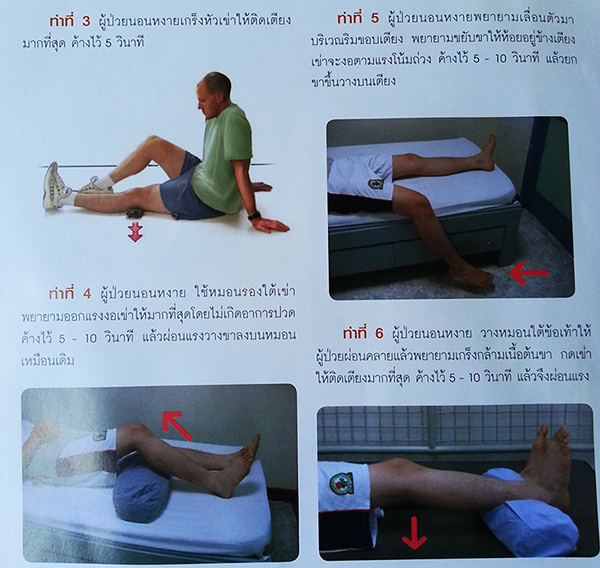 ผ่าตัดเปลี่ยนข้อเข่าเทียม