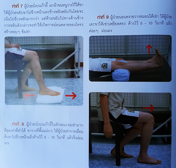 ผ่าตัดเปลี่ยนข้อเข่าเทียม