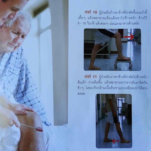 ผ่าตัดเปลี่ยนข้อเข่าเทียม