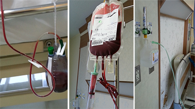 ผ่าตัดเปลี่ยนข้อเข่าเทียม