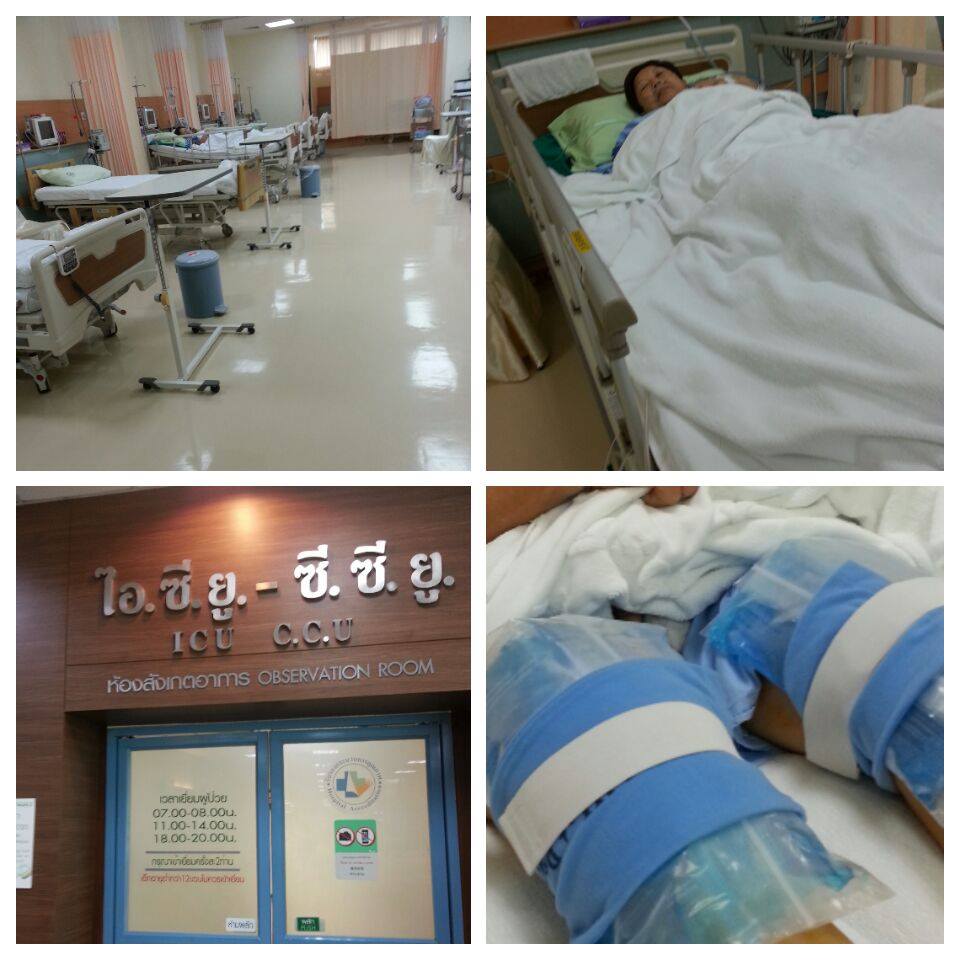 ผ่าตัดเปลี่ยนข้อเข่าเทียม