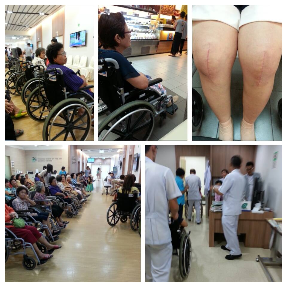 ผ่าตัดข้อเข่าเทียม